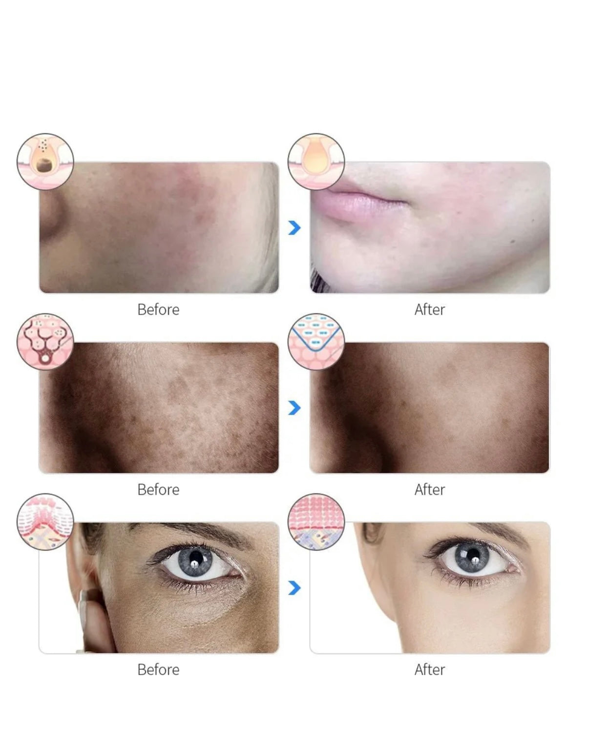 Glow Mask Pursonic 7-in-1 LED Light